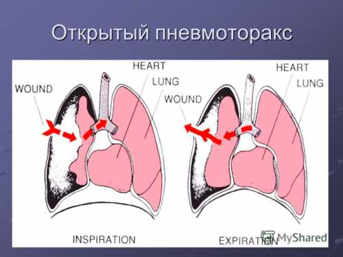 Профилактика