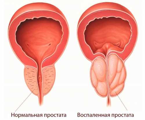 Прогноз зависит от длины матки