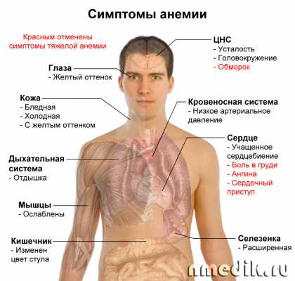 Симптомы причины и лечение анемии